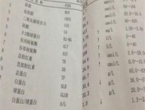 谷草转氨酶偏高的原因是什么2